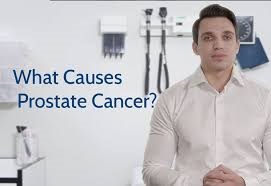 CAUSES OF PROSTATE CANCER