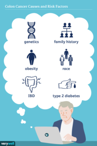 Causes of Colon Cancer