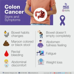 Common Symptoms of Colon Cancer