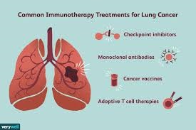 Immunotherapy lung cancer treatment