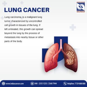 LUNG CANCER IMAGE