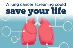 Screening for Lung Cancer