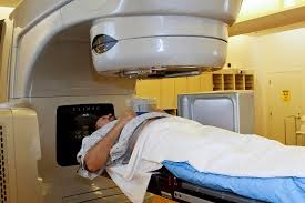 RADIATION THERAPY FOR RECTUM CANCER