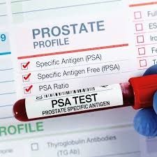 Prostate-Specific Antigen (PSA) Blood Test