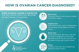 SCREENING METHODS TO DETECT OVARIAN CANCER