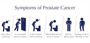 SYMPTOMS OF PROSTATE CANCER