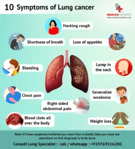 SYMPTOMS OF LUNG CANCER