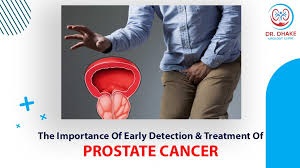 THE IMPORTANCE OF EARLY DETECTION OF PROSTATE CANCER