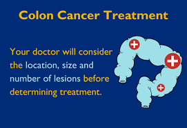 Choosing the Right Treatment for colon cancer