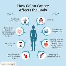 PHYSICAL CHALLENGES OF A COLON CANCER PATIENT: PAIN, FATIGUE, AND CHANGES IN BOWEL HABITS 