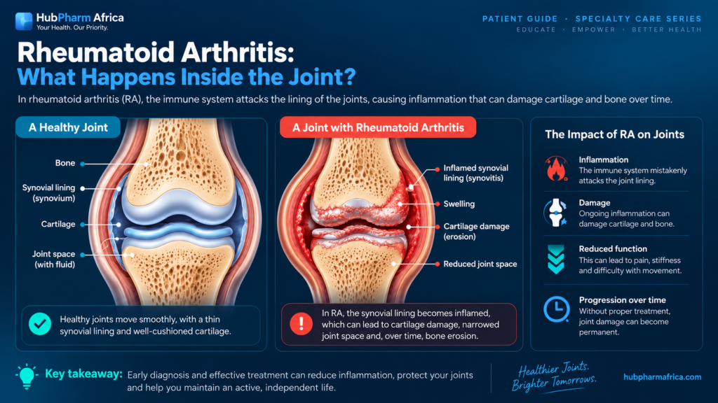 rheumatoid arthritis in Nigeria